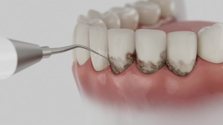 Trusted Teeth Cleaning And Checkup service in Easley, SC - Dentist Open Now